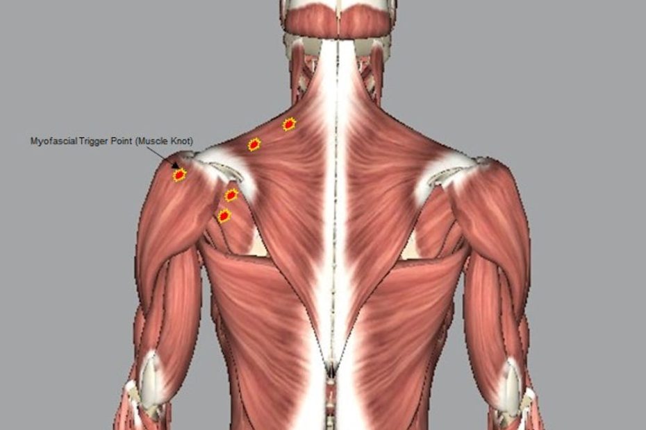 How Do You Roll Out A Muscle Knot: Effective Techniques