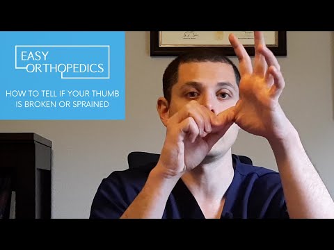 How to tell if your thumb is broken or sprained